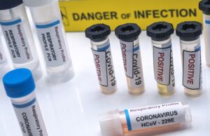 vials of samples with positive results from patients infected with covid 19 coronavirus in a laboratory, conceptual image