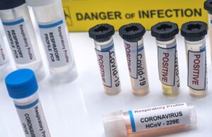 vials of samples with positive results from patients infected with covid 19 coronavirus in a laboratory, conceptual image