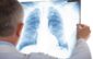 investigatii pulmonare