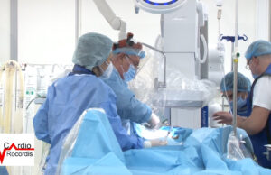 operație în premieră în românia, la timișoara, la spitalul rocordis