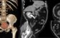 urografia prin tomografie computerizată investigație gratuită la spitalul victor babes din timisoara